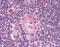 Toll Like Receptor 2 antibody, ARP30551_P050, Aviva Systems Biology, Immunohistochemistry paraffin image 