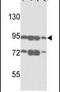 ATP Binding Cassette Subfamily B Member 5 antibody, PA5-13114, Invitrogen Antibodies, Western Blot image 