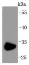 CD74 Molecule antibody, NBP2-66762, Novus Biologicals, Western Blot image 