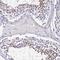 UBE2L3 antibody, HPA045609, Atlas Antibodies, Immunohistochemistry frozen image 