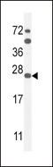Sodium Voltage-Gated Channel Beta Subunit 1 antibody, 55-309, ProSci, Western Blot image 