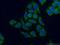 S100 Calcium Binding Protein A14 antibody, 10489-1-AP, Proteintech Group, Immunofluorescence image 
