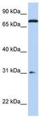 Mitogen-activated protein kinase kinase kinase kinase 1 antibody, TA338986, Origene, Western Blot image 