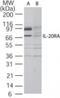Interleukin-20 receptor subunit alpha antibody, NB100-56409, Novus Biologicals, Western Blot image 