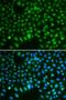 DLG Associated Protein 5 antibody, LS-C748618, Lifespan Biosciences, Immunofluorescence image 