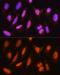 Heat Shock Protein Family A (Hsp70) Member 2 antibody, GTX33251, GeneTex, Immunocytochemistry image 