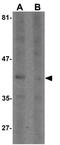 Septin 1 antibody, GTX31484, GeneTex, Western Blot image 