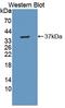 Erythrocyte Membrane Protein Band 4.1 antibody, LS-C374382, Lifespan Biosciences, Western Blot image 