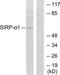 Signal Regulatory Protein Alpha antibody, TA313227, Origene, Western Blot image 