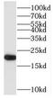 RAP2B, Member Of RAS Oncogene Family antibody, FNab07114, FineTest, Western Blot image 