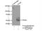 Thioredoxin Interacting Protein antibody, 18243-1-AP, Proteintech Group, Immunoprecipitation image 