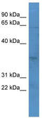Olfactory Receptor Family 2 Subfamily J Member 2 antibody, TA342714, Origene, Western Blot image 