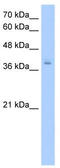 Poly(rC)-binding protein 2 antibody, TA345904, Origene, Western Blot image 