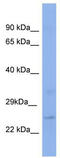 Krueppel-like factor 16 antibody, TA345431, Origene, Western Blot image 