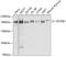 SET Domain Bifurcated Histone Lysine Methyltransferase 1 antibody, A00881, Boster Biological Technology, Western Blot image 