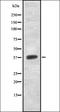 Gamma-Aminobutyric Acid Type B Receptor Subunit 2 antibody, orb336846, Biorbyt, Western Blot image 