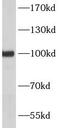 Protocadherin-15 antibody, FNab10097, FineTest, Western Blot image 