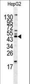 HOMER1 antibody, LS-C100888, Lifespan Biosciences, Western Blot image 