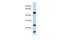 Ubiquitin Conjugating Enzyme E2 L6 antibody, GTX46937, GeneTex, Western Blot image 