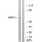 Nuclear RNA Export Factor 3 antibody, A11497, Boster Biological Technology, Western Blot image 