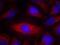 Phospholipase C Gamma 2 antibody, A03572, Boster Biological Technology, Immunofluorescence image 