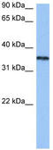 Heterogeneous Nuclear Ribonucleoprotein A2/B1 antibody, TA343942, Origene, Western Blot image 