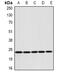 DIRAS Family GTPase 3 antibody, abx225145, Abbexa, Western Blot image 