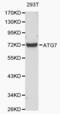 Myeloid Derived Growth Factor antibody, LS-C192366, Lifespan Biosciences, Western Blot image 