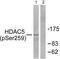 Histone deacetylase 5 antibody, TA326050, Origene, Western Blot image 