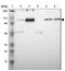 Ubiquitin carboxyl-terminal hydrolase 13 antibody, NBP1-83088, Novus Biologicals, Western Blot image 