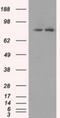 SCY1 Like Pseudokinase 3 antibody, NBP1-47956, Novus Biologicals, Western Blot image 