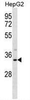 Sulfotransferase 1A3/1A4 antibody, AP54101PU-N, Origene, Western Blot image 