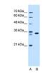 Arginine-Fifty Homeobox antibody, NBP1-79220, Novus Biologicals, Western Blot image 
