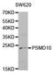 26S proteasome non-ATPase regulatory subunit 10 antibody, TA327218, Origene, Western Blot image 