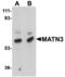 Matrilin 3 antibody, MBS150370, MyBioSource, Western Blot image 