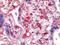 Platelet Factor 4 antibody, AP22822PU-N, Origene, Immunohistochemistry paraffin image 