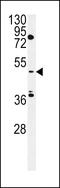 Cytokine-dependent hematopoietic cell linker antibody, 57-368, ProSci, Western Blot image 