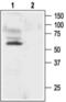 Potassium Voltage-Gated Channel Subfamily A Member 1 antibody, PA5-77577, Invitrogen Antibodies, Western Blot image 