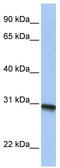 Fibronectin Type III Domain Containing 11 antibody, TA335477, Origene, Western Blot image 