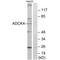 Uncharacterized aarF domain-containing protein kinase 4 antibody, A10608, Boster Biological Technology, Western Blot image 