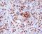 Pancreas/duodenum homeobox protein 1 antibody, M00491, Boster Biological Technology, Immunohistochemistry paraffin image 