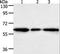 Aldo-Keto Reductase Family 1 Member A1 antibody, LS-C405865, Lifespan Biosciences, Western Blot image 