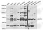 Microcephalin 1 antibody, A5472, ABclonal Technology, Western Blot image 