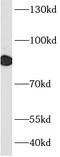 Ribonucleotide Reductase Catalytic Subunit M1 antibody, FNab07494, FineTest, Western Blot image 