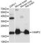 Vesicle Associated Membrane Protein 2 antibody, A1249, ABclonal Technology, Western Blot image 