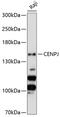 Centromere Protein J antibody, 23-708, ProSci, Western Blot image 