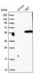Dihydrolipoamide Branched Chain Transacylase E2 antibody, PA5-55317, Invitrogen Antibodies, Western Blot image 