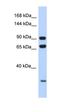 Armadillo Repeat Containing 4 antibody, orb326264, Biorbyt, Western Blot image 