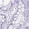 Spermatid Associated antibody, NBP1-86592, Novus Biologicals, Immunohistochemistry paraffin image 