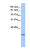 Calmin antibody, NBP1-91449, Novus Biologicals, Western Blot image 